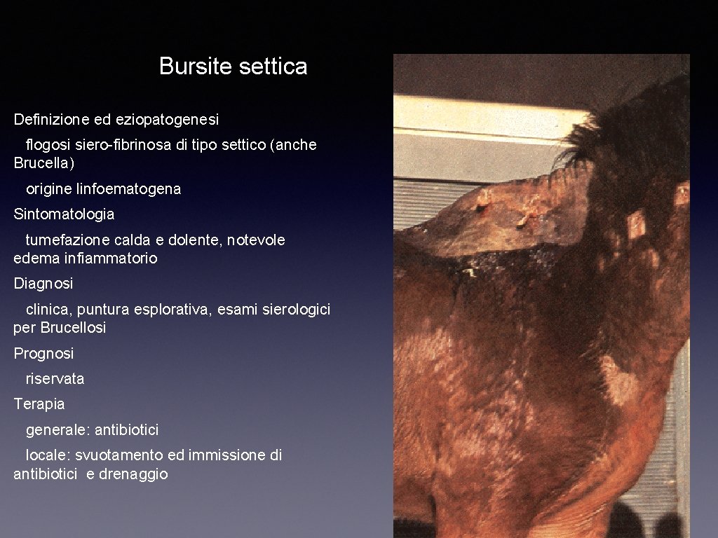 Bursite settica Definizione ed eziopatogenesi flogosi siero-fibrinosa di tipo settico (anche Brucella) origine linfoematogena