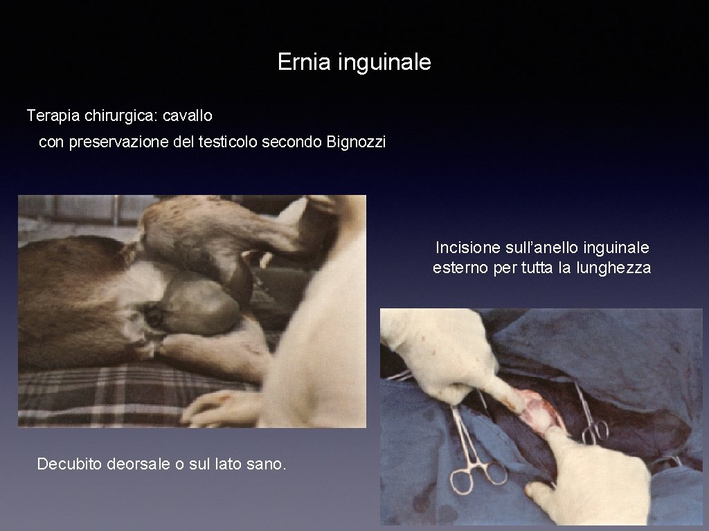 Ernia inguinale Terapia chirurgica: cavallo con preservazione del testicolo secondo Bignozzi Incisione sull’anello inguinale