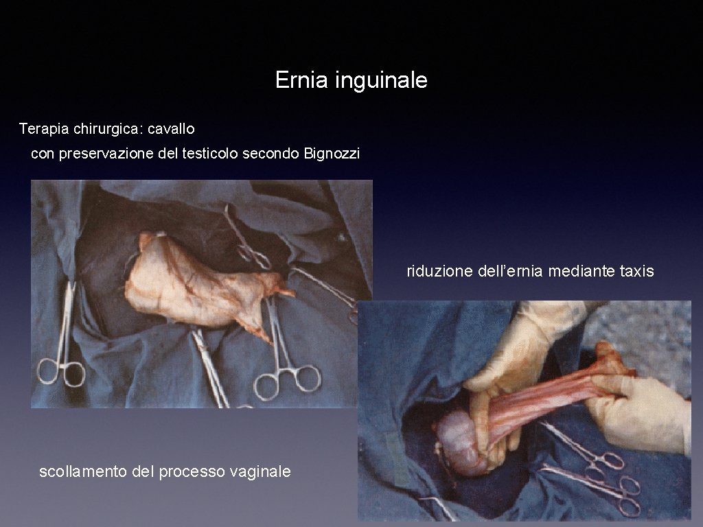 Ernia inguinale Terapia chirurgica: cavallo con preservazione del testicolo secondo Bignozzi riduzione dell’ernia mediante