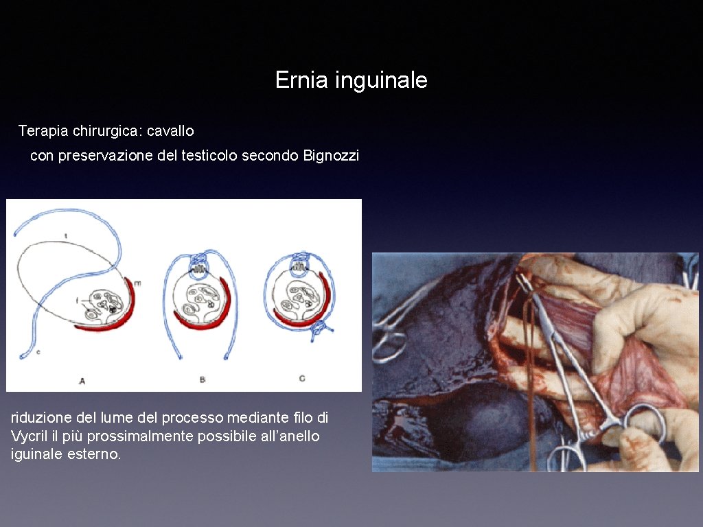Ernia inguinale Terapia chirurgica: cavallo con preservazione del testicolo secondo Bignozzi riduzione del lume
