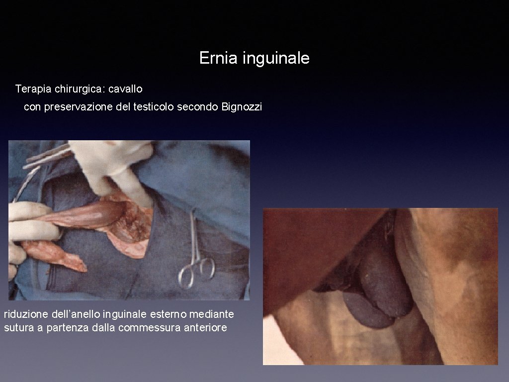 Ernia inguinale Terapia chirurgica: cavallo con preservazione del testicolo secondo Bignozzi riduzione dell’anello inguinale