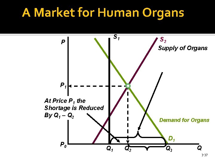 A Market for Human Organs S 1 P S 2 Supply of Organs Shortage