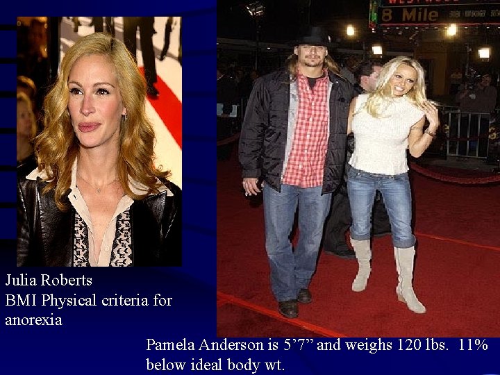 Julia Roberts BMI Physical criteria for anorexia Pamela Anderson is 5’ 7” and weighs