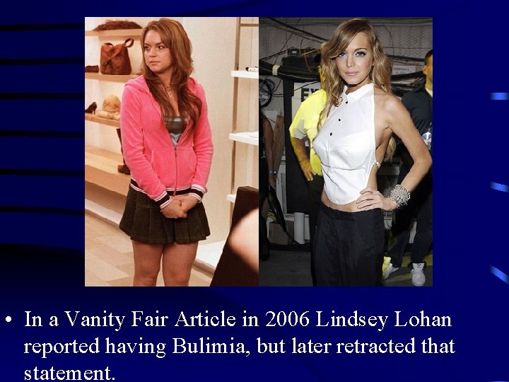  • In a Vanity Fair Article in 2006 Lindsey Lohan reported having Bulimia,