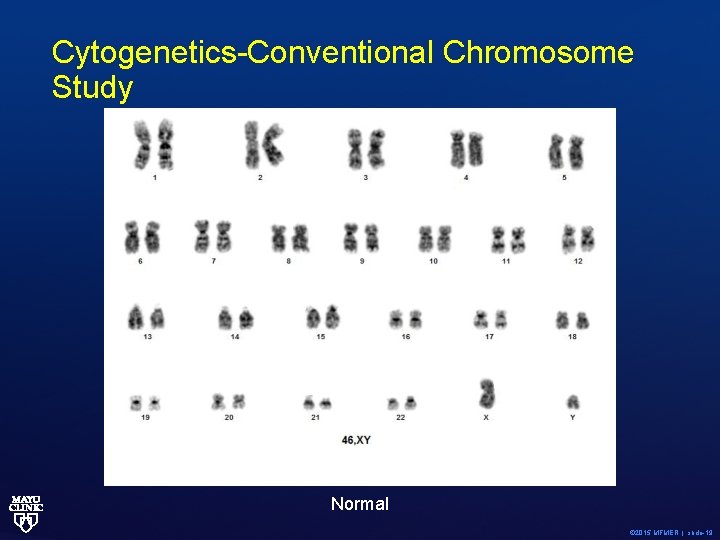 Cytogenetics-Conventional Chromosome Study Normal © 2015 MFMER | slide-19 