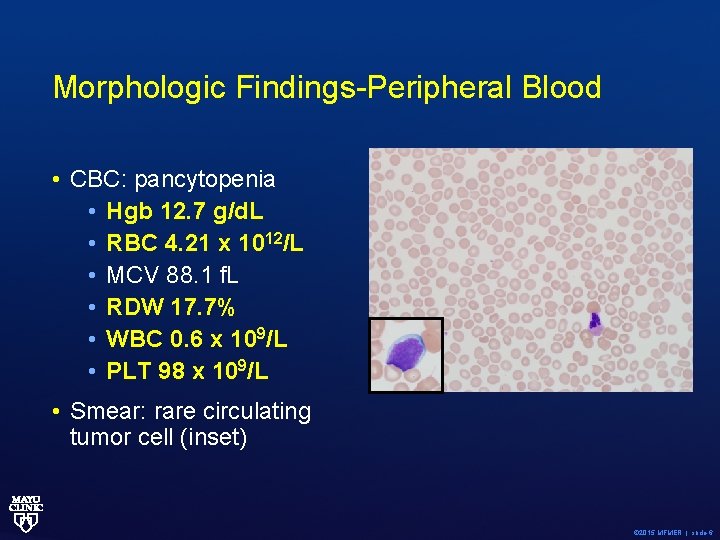 Morphologic Findings-Peripheral Blood • CBC: pancytopenia • Hgb 12. 7 g/d. L • RBC