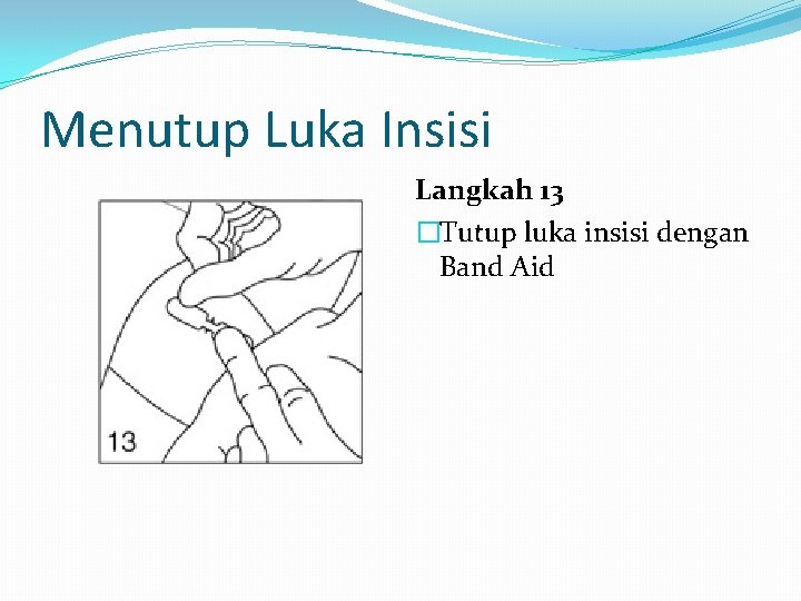 Menutup Luka Insisi Langkah 13 �Tutup luka insisi dengan Band Aid 