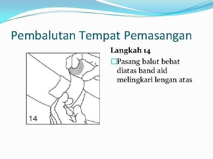 Pembalutan Tempat Pemasangan Langkah 14 �Pasang balut bebat diatas band aid melingkari lengan atas