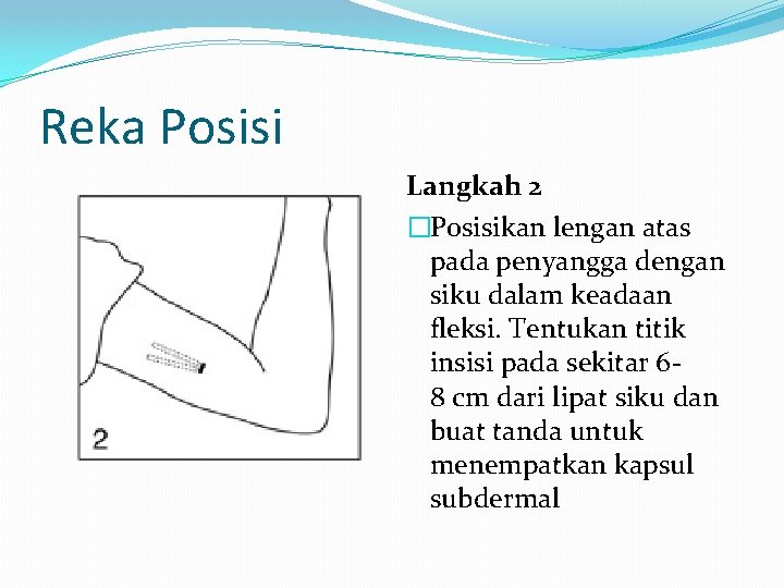 Reka Posisi Langkah 2 �Posisikan lengan atas pada penyangga dengan siku dalam keadaan fleksi.