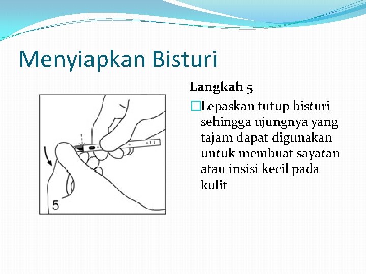 Menyiapkan Bisturi Langkah 5 �Lepaskan tutup bisturi sehingga ujungnya yang tajam dapat digunakan untuk