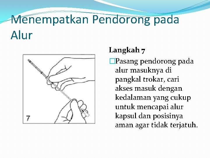 Menempatkan Pendorong pada Alur Langkah 7 �Pasang pendorong pada alur masuknya di pangkal trokar,