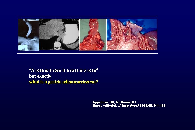 “A rose is a rose” but exactly what is a gastric adenocarcinoma? Appelman HR,