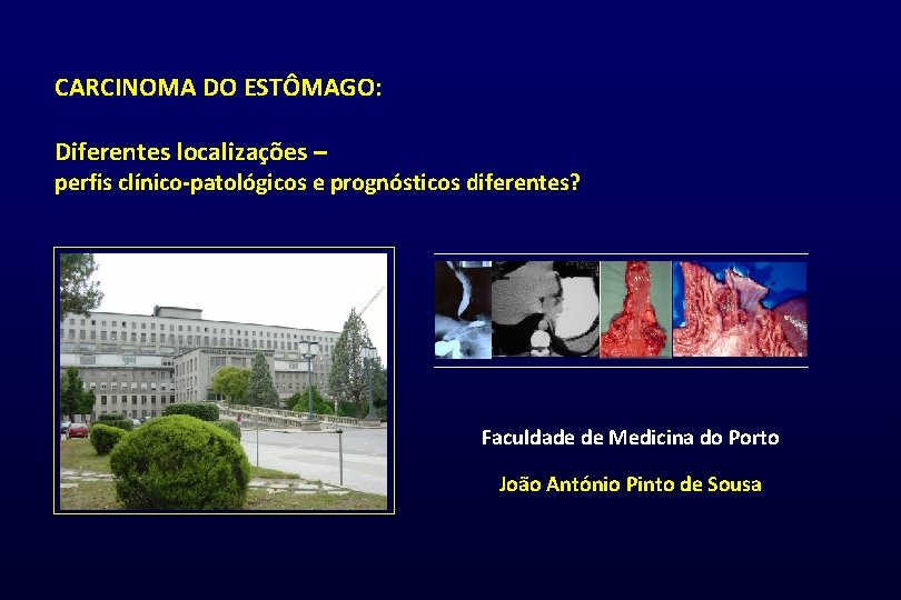 CARCINOMA DO ESTÔMAGO: Diferentes localizações – perfis clínico-patológicos e prognósticos diferentes? Faculdade de Medicina