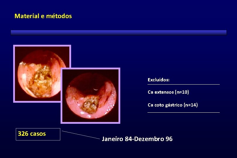 Material e métodos Excluídos: Ca extensos (n=10) Ca coto gástrico (n=14) 326 casos Janeiro