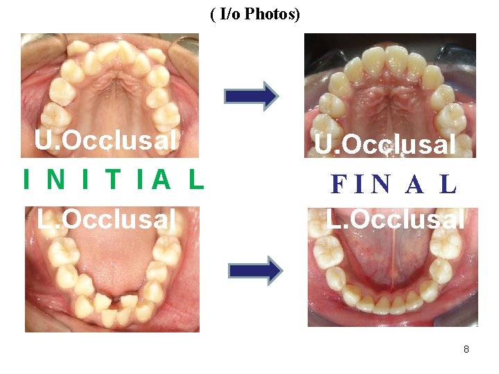 ( I/o Photos) U. Occlusal I N I T IA L L. Occlusal U.