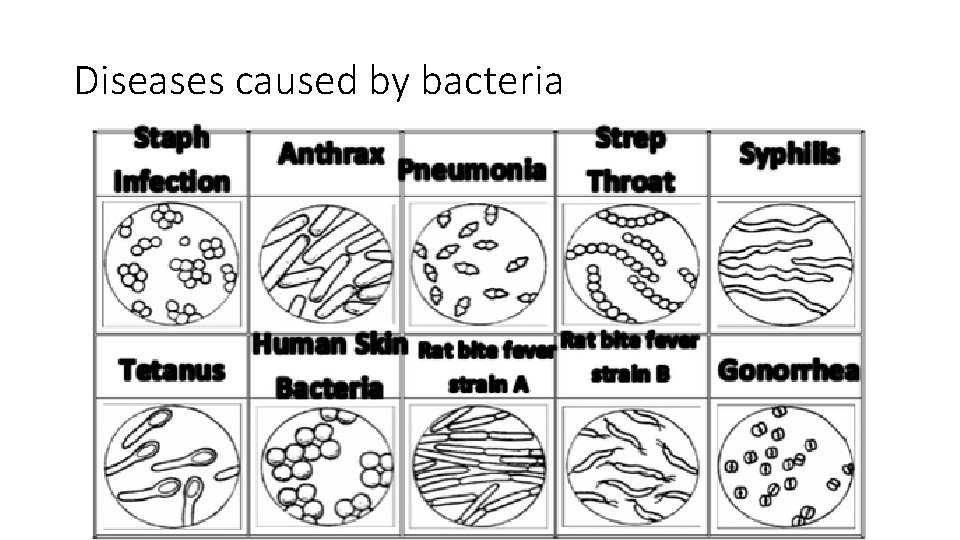 Diseases caused by bacteria 