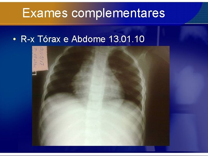 Exames complementares • R-x Tórax e Abdome 13. 01. 10 