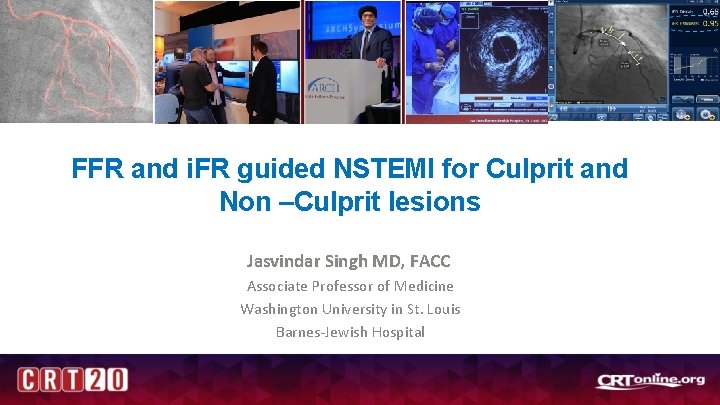 FFR and i. FR guided NSTEMI for Culprit and Non –Culprit lesions Jasvindar Singh