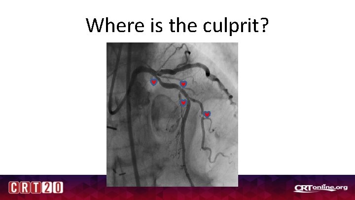 Where is the culprit? 