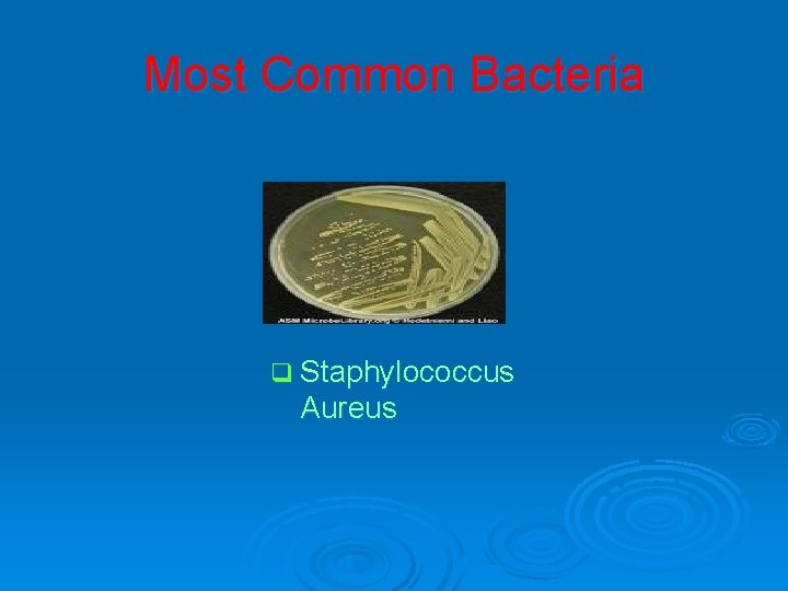Most Common Bacteria q Staphylococcus Aureus 
