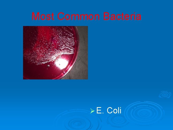 Most Common Bacteria Ø E. Coli 