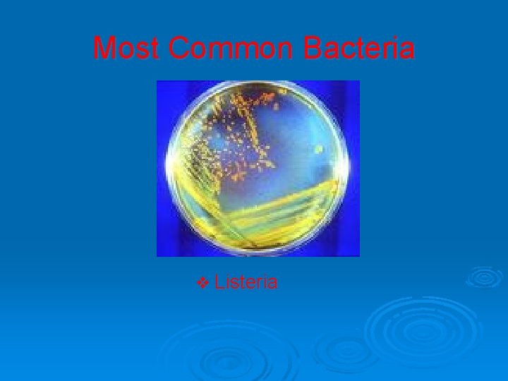 Most Common Bacteria v Listeria 