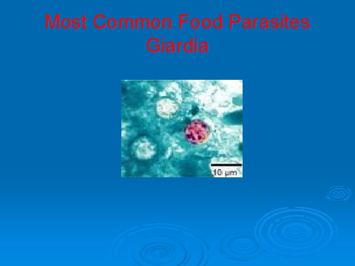 Most Common Food Parasites Giardia 