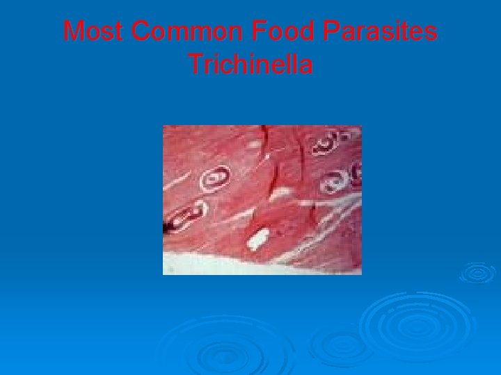 Most Common Food Parasites Trichinella 