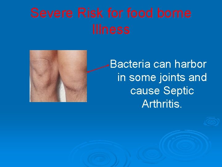 Severe Risk for food borne Illness Bacteria can harbor in some joints and cause