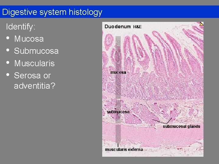 Digestive system histology Identify: • Mucosa • Submucosa • Muscularis • Serosa or adventitia?
