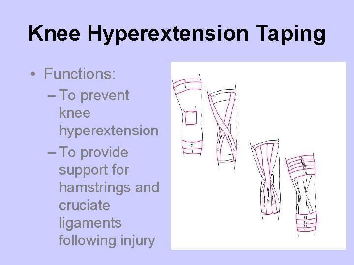 Knee Hyperextension Taping • Functions: – To prevent knee hyperextension – To provide support
