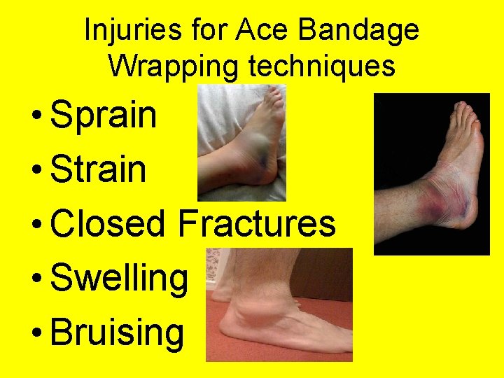 Injuries for Ace Bandage Wrapping techniques • Sprain • Strain • Closed Fractures •