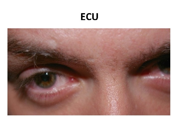 ECU 