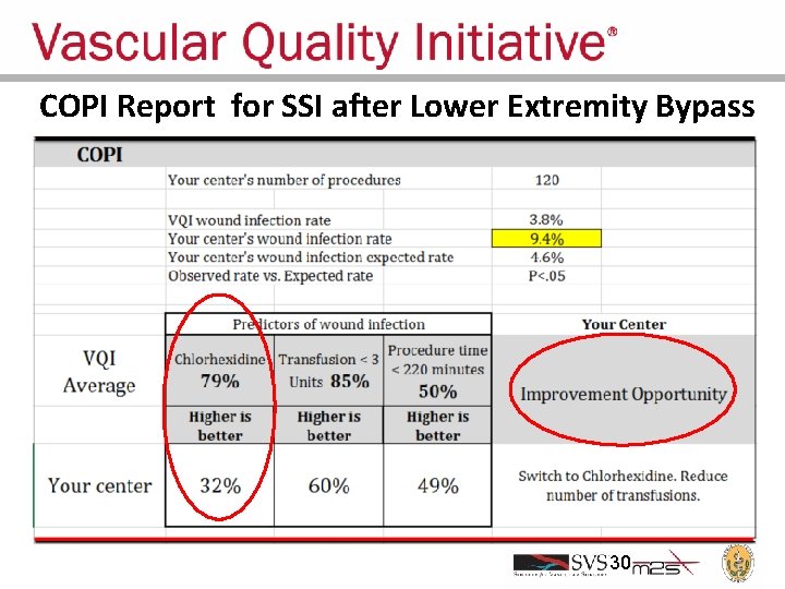 COPI Report for SSI after Lower Extremity Bypass 30 