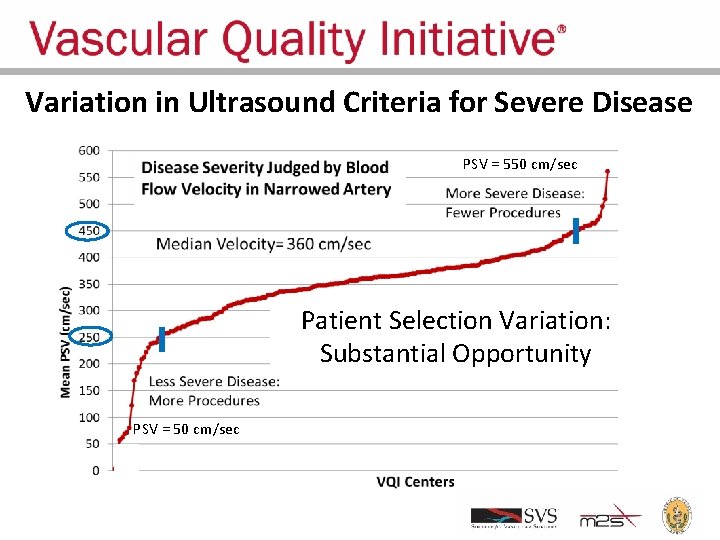 Variation in Ultrasound Criteria for Severe Disease PSV = 550 cm/sec Patient Selection Variation: