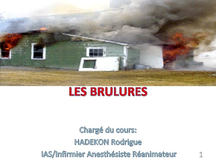 LES BRULURES Chargé du cours: HADEKON Rodrigue IAS/Infirmier Anesthésiste Réanimateur 1 