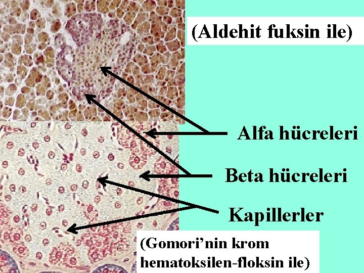 (Aldehit fuksin ile) Alfa hücreleri Beta hücreleri Kapillerler (Gomori’nin krom hematoksilen-floksin ile) 