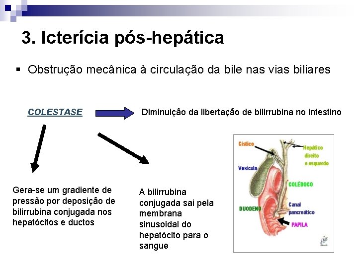 3. Icterícia pós-hepática § Obstrução mecânica à circulação da bile nas vias biliares COLESTASE