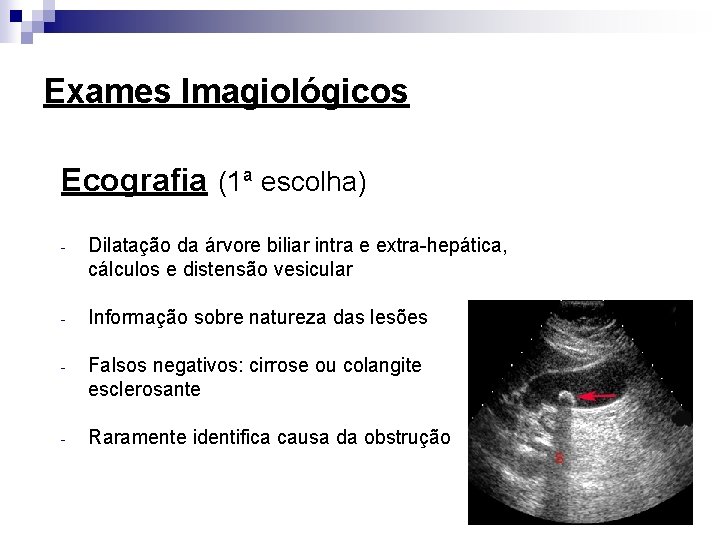 Exames Imagiológicos Ecografia (1ª escolha) - Dilatação da árvore biliar intra e extra-hepática, cálculos