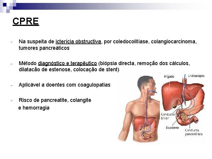 CPRE - Na suspeita de icterícia obstructiva, por coledocolitíase, colangiocarcinoma, tumores pancreáticos - Método