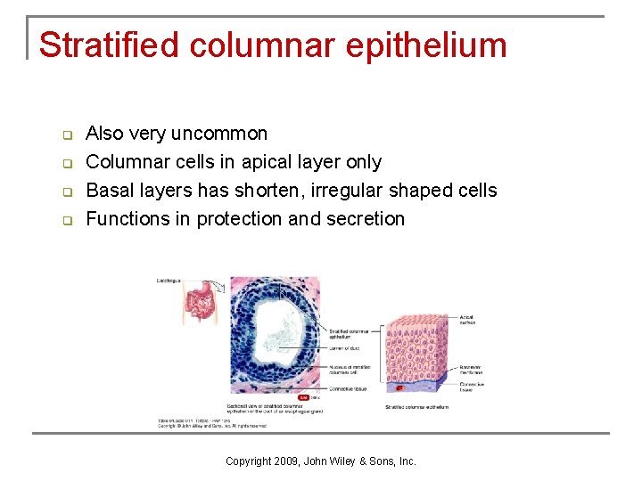 Stratified columnar epithelium q q Also very uncommon Columnar cells in apical layer only