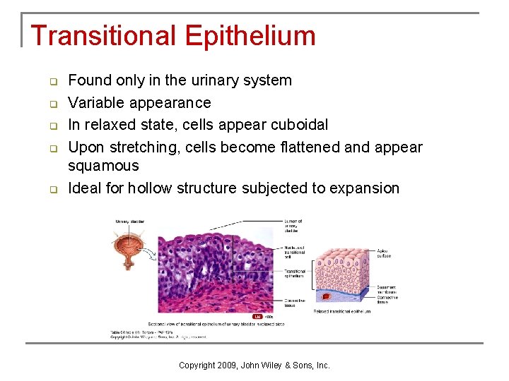 Transitional Epithelium q q q Found only in the urinary system Variable appearance In