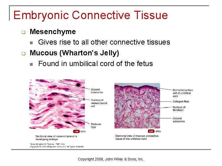 Embryonic Connective Tissue q q Mesenchyme n Gives rise to all other connective tissues