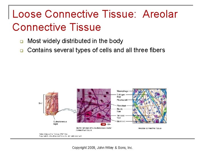 Loose Connective Tissue: Areolar Connective Tissue q q Most widely distributed in the body
