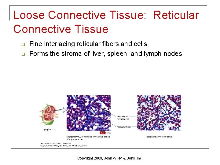 Loose Connective Tissue: Reticular Connective Tissue q q Fine interlacing reticular fibers and cells