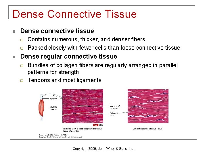 Dense Connective Tissue n Dense connective tissue q q n Contains numerous, thicker, and