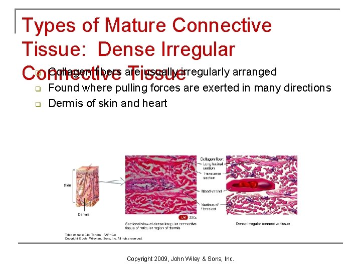 Types of Mature Connective Tissue: Dense Irregular Collagen fibers are usually irregularly arranged Connective