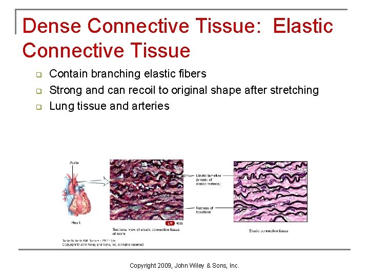 Dense Connective Tissue: Elastic Connective Tissue q q q Contain branching elastic fibers Strong