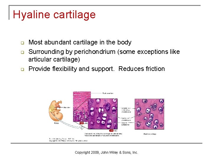 Hyaline cartilage q q q Most abundant cartilage in the body Surrounding by perichondrium