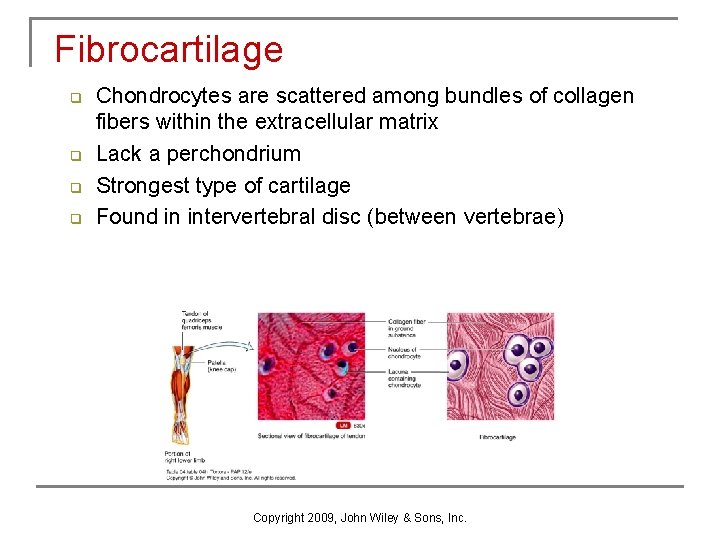 Fibrocartilage q q Chondrocytes are scattered among bundles of collagen fibers within the extracellular